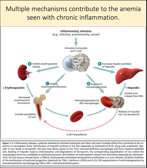 If ferritin levels are optimal and inflammation is low, low hemoglobin levels could be due to a change in blood volume, as . . Low ferritin high platelets